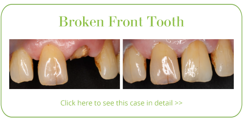 Cosmetic Dentistry Skegness